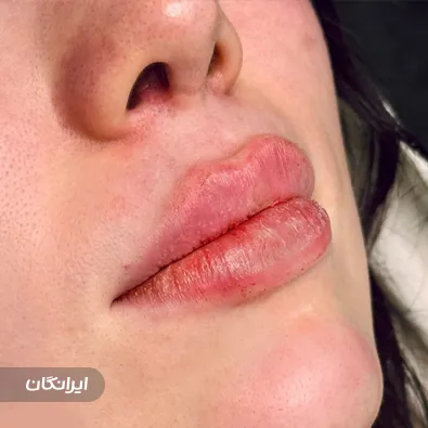 کلینیک زیبایی نیکا