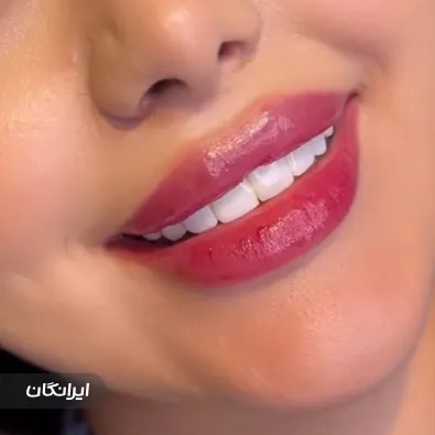 کلینیک زیبایی نیکا