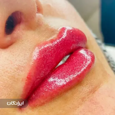 کلینیک زیبایی دکتر فاطمه میرزاپورحاجی