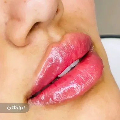 کلینیک زیبایی دکتر فاطمه میرزاپورحاجی