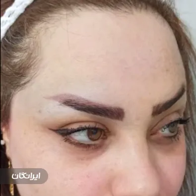 کلینیک کاشت مو آرام