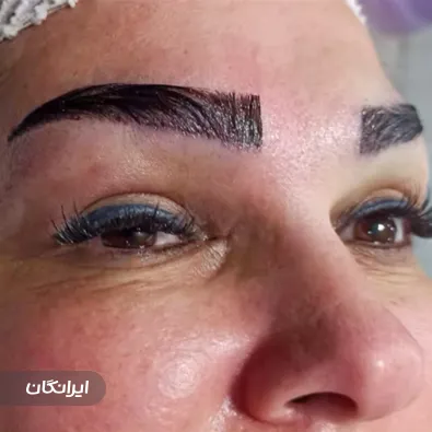 کلینیک کاشت مو آرام