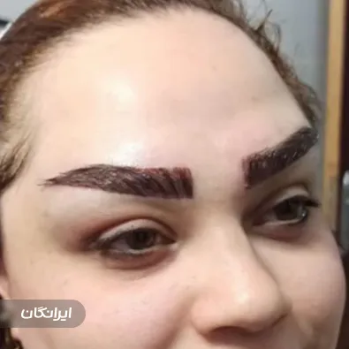 کلینیک کاشت مو آرام