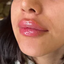 کلینیک زیبایی شاین اسکین