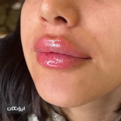 کلینیک زیبایی شاین اسکین