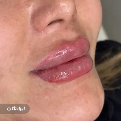 کلینیک زیبایی شاین اسکین