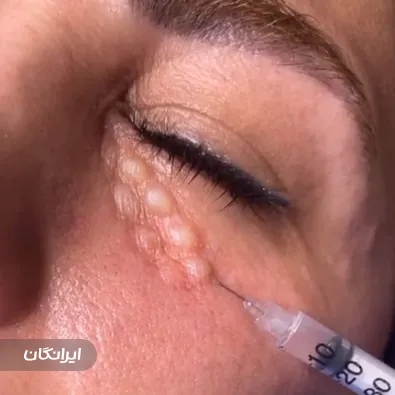 کلینیک زیبایی شاین اسکین