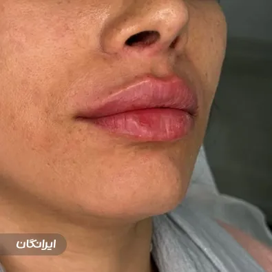 کلینیک زیبایی دکتر غزل حسن پور