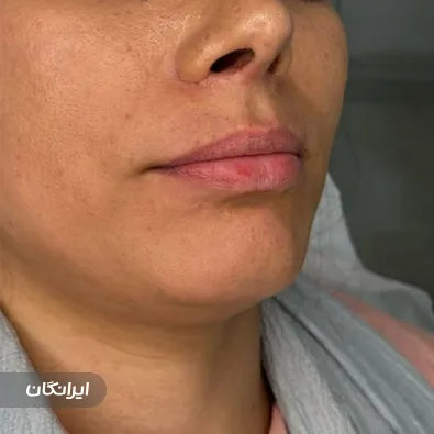 کلینیک زیبایی دکتر غزل حسن پور