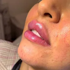 کلینیک زیبایی دکتر غزل حسن پور