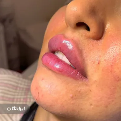 کلینیک زیبایی دکتر غزل حسن پور