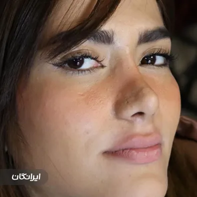 کلینیک زیبایی سلین