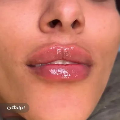 کلینیک زیبایی دکتر پیام بهرو