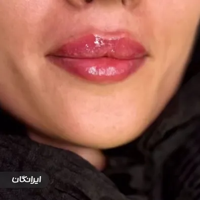 کلینیک زیبایی دکتر پیام بهرو