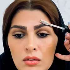 کلینیک کاشت لند