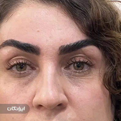 کلینیک کاشت لند