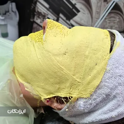 مرکز مراقبت پوست و مو تینا