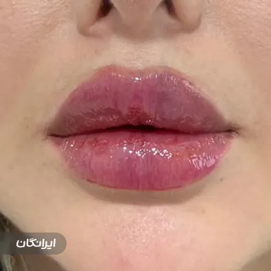 مرکز زیبایی و لیزر دکتر ندا حیدربیگی