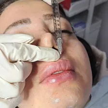 کلینیک زیبایی پریناز