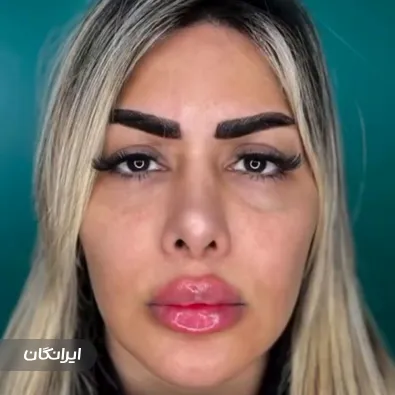 کلینیک زیبایی پریناز