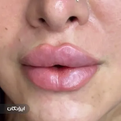 کلینیک زیبایی آی سو