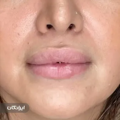 کلینیک زیبایی آی سو