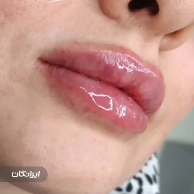 کلینیک زیبایی دکتر زهرا اسدپور