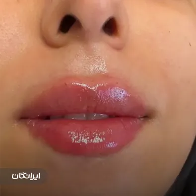 کلینیک زیبایی نورارز