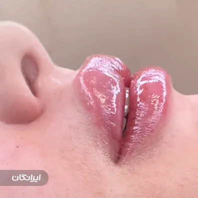 کلینیک زیبایی نورارز