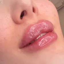 کلینیک زیبایی نورارز