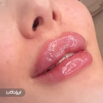 کلینیک زیبایی نورارز