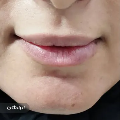 کلینیک زیبایی آیسل