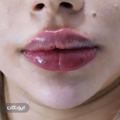 کلینیک زیبایی ماهانا