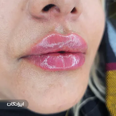 کلینیک زیبایی ماهانا