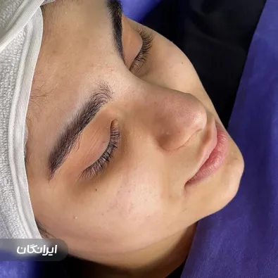 کلینیک زیبایی اکسیر