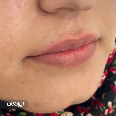 کلینیک زیبایی دکتر مونا افشاری