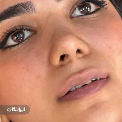 کلینیک زیبایی دکتر کوثر گزمه