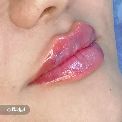 کلینیک زیبایی دکتر ندا سارانی