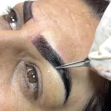 کلینیک کاشت مو آفرینش