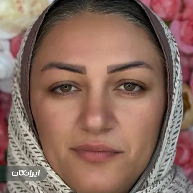 کلینیک کاشت مو آفرینش