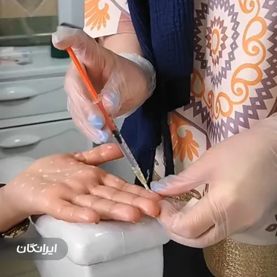 کلینیک زیبایی متیس