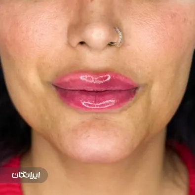 کلینیک زیبایی رحمتی