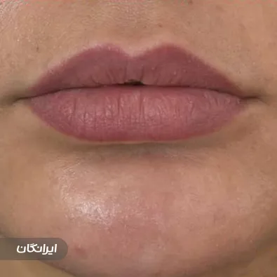 کلینیک زیبایی رحمتی