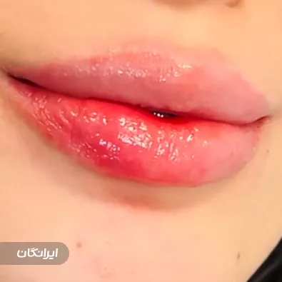 کلینیک زیبایی ثمینا