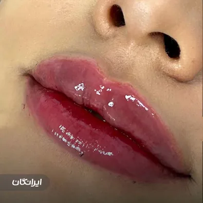 کلینیک زیبایی ثمینا