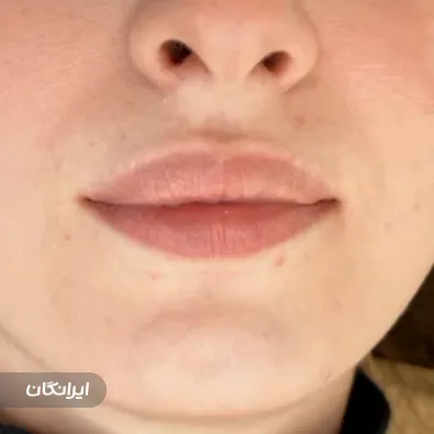 کلینیک زیبایی آنیل