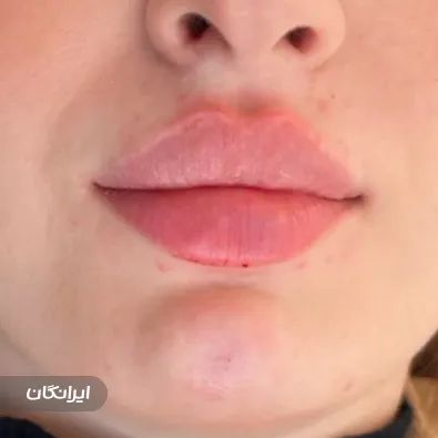 کلینیک زیبایی آنیل