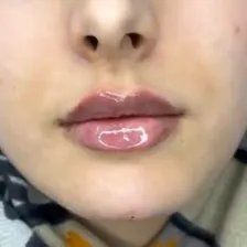 کلینیک زیبایی آنیل