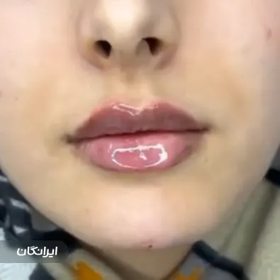 کلینیک زیبایی آنیل