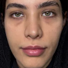کلینیک زیبایی هانیسا